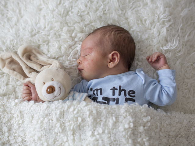 Piel atópica de bebé: todo lo que necesitas saber